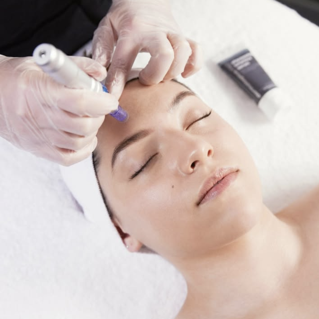 Luminfusion Skin Treatment Cairns